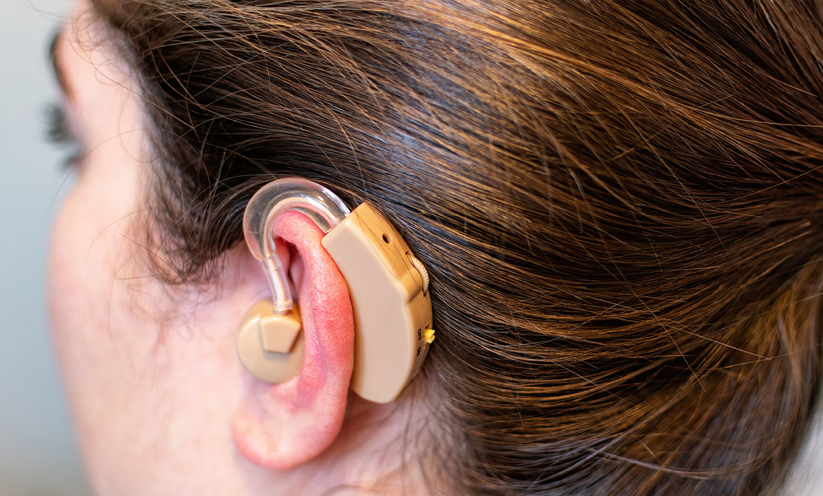 Audioprótesis y estimulación auditiva